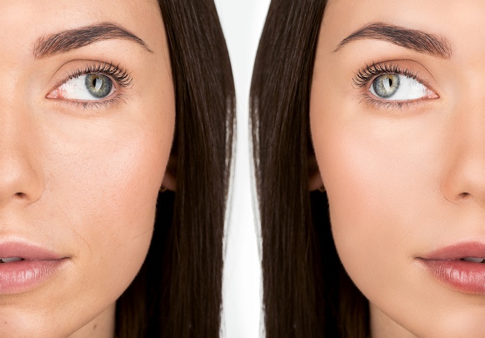 Before and after shot of a woman after using a skincare product