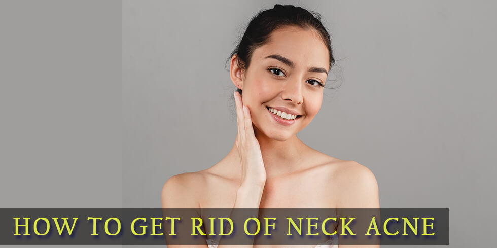 Getting Rid of Neck Acne